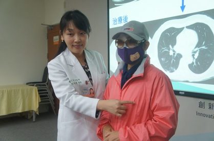 劉怡君醫師解說病友肺部病灶位置