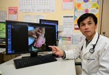 2歲童燒不停 血輪眼、手腳「腫得像麵龜」 原來是川崎症惹的禍