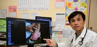2歲童燒不停 血輪眼、手腳「腫得像麵龜」 原來是川崎症惹的禍