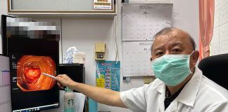 便祕一整天還血便 婦頭暈送醫檢查出大腸癌