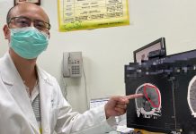 原要換膝關節竟變「緊急開腦」 跨科團隊及時攔截隱形殺手
