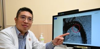 機智醫師自救真實版! 名醫突胸痛「從左痛到右」緊急就醫揪出體內炸彈「穿透性主動脈潰瘍」